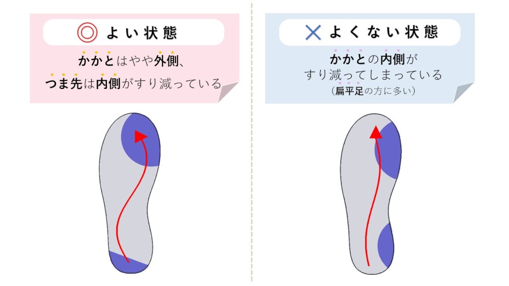 靴底のすり減り方チェック図