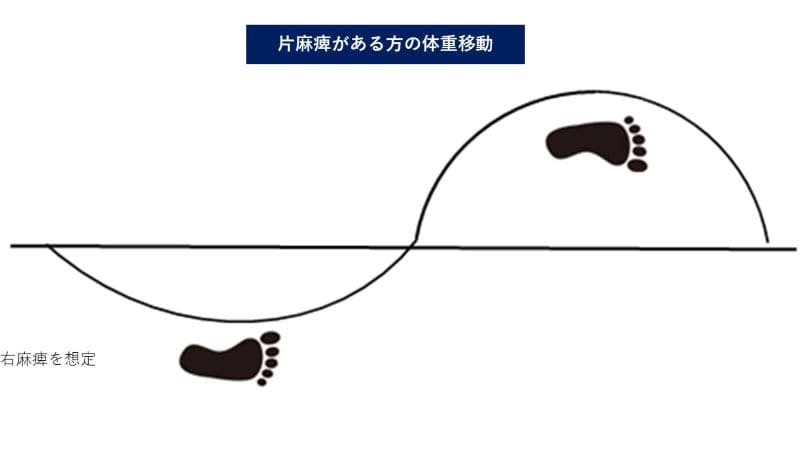 歩行　介助　軌跡