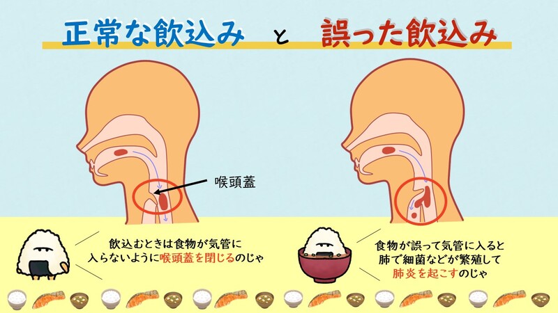 正常な飲み込みと誤嚥の図解