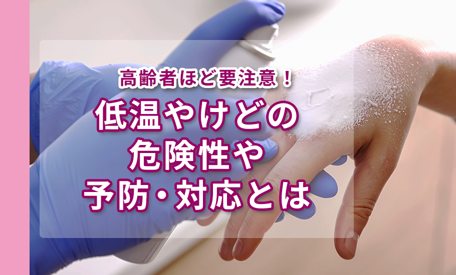 高齢者ほど要注意!低温やけどの危険性や予防・対応とは