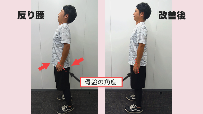 反り腰と通常腰の見比べ