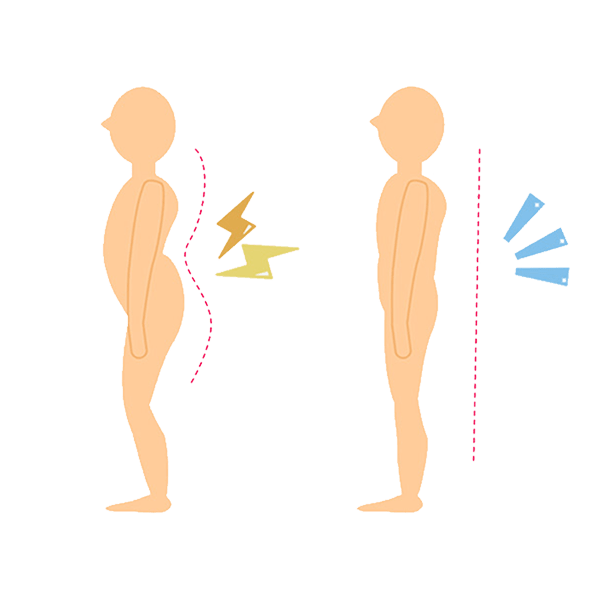 理学療法士おすすめ！反り腰が改善するストレッチやグッズを紹介